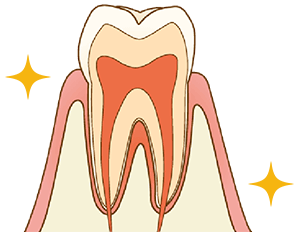 神経を残す事で歯の寿命を延ばす事ができます