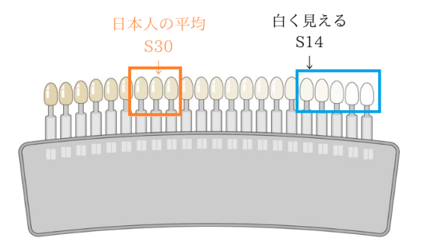 歯の色見本