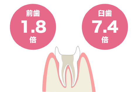 神経の無い歯は、抜歯のリスクが1.8倍～7.4倍？